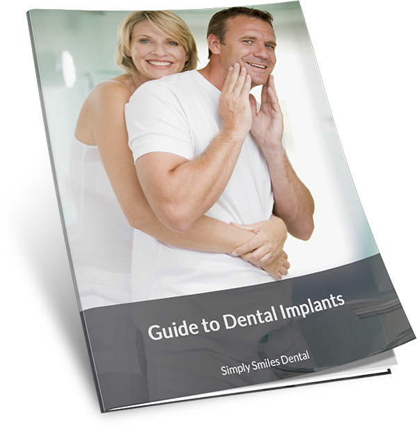 Guide to Dental Implants by SSD