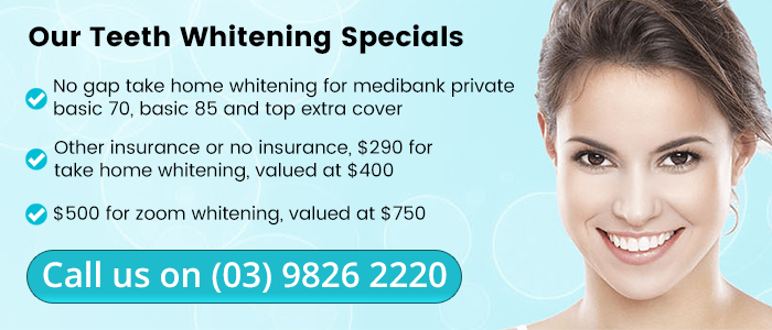 Our Teeth Whitening Specials Banner | Dentist Toorak