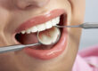 Dental Care Second Opinions?