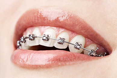 Simply Smiles Dental | Orthodontics - Dentist Toorak