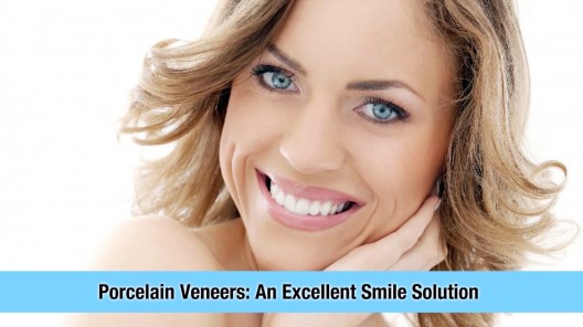 Porcelain Veneers An Excellent Smile Solution