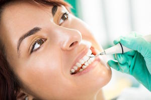 Types of Professional Teeth Cleaning for Different Dental Needs