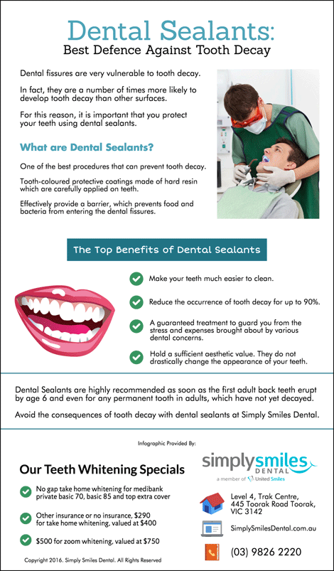 Dental Sealants – Best Defence Against Tooth Decay