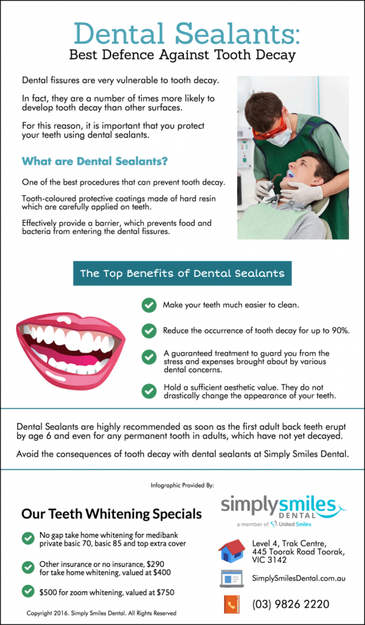 Dental Sealants – Best Defence Against Tooth Decay