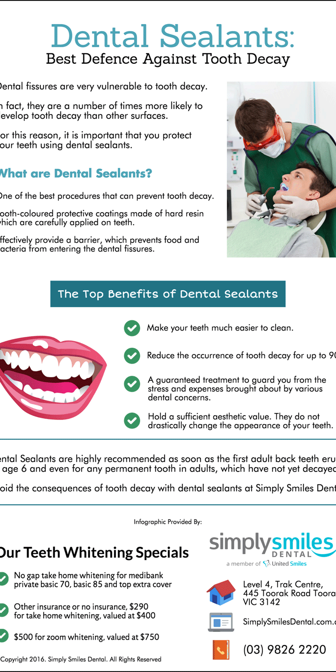 Dental Sealants – Best Defence Against Tooth Decay