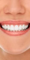 Improving Smiles with Tooth Coloured Fillings in Toorak