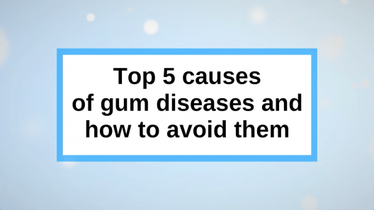 Top 5 causes of gum diseases and how to avoid them