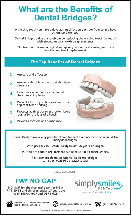 What-are-the-Benefits-of-Dental-Bridges