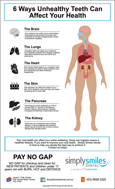 Toorak-Dentist-Tips-6-Ways-Unhealthy-Teeth-Can-Affect-Your-Health