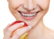 4-ways-to-eliminate-gingivitis-related-to-braces-toorak-dentist