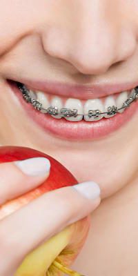 4-ways-to-eliminate-gingivitis-related-to-braces-toorak-dentist 4-ways-to-eliminate-gingivitis-related-to-braces-toorak-dentist
