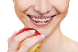 4-ways-to-eliminate-gingivitis-related-to-braces-toorak-dentist