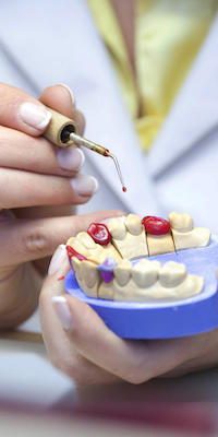 how-long-should-your-dental-crowns-last-mernda-dentist How Long Should Your Dental Crowns Last?