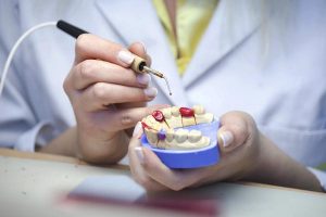 How Long Should Your Dental Crowns Last?