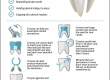 Dental Crowns: All You Need To Know
