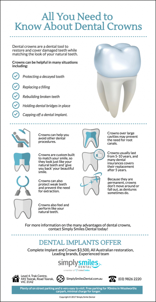Dental Crowns: All You Need To Know